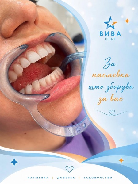 За насмевка што зборува за вас — Вива Стар